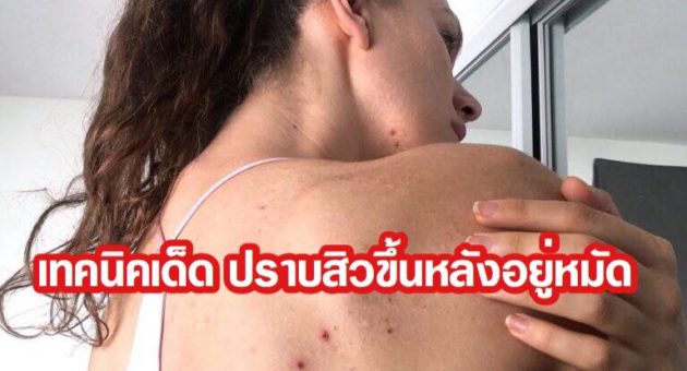 35992073_1035003953344758_3504410047557926912_n