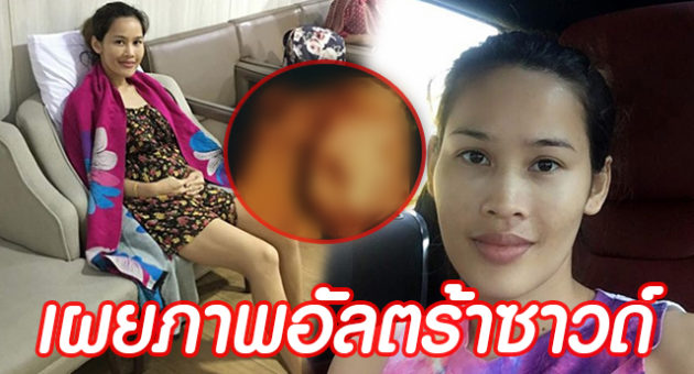 ดกะพำัไำ