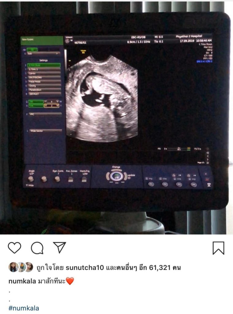TV Pool Online