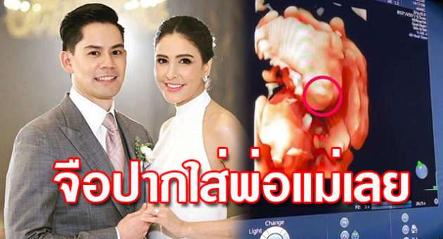 จือปาก