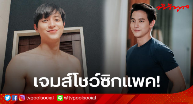 จ3