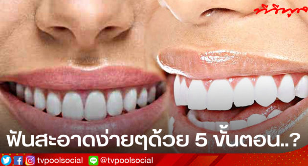 BE900402-21E1-4C45-9932-C04689C01746