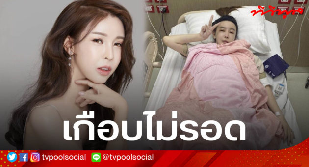 อ2