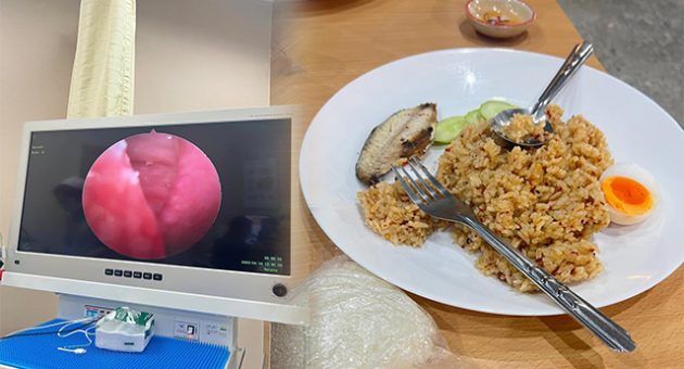ก้าง